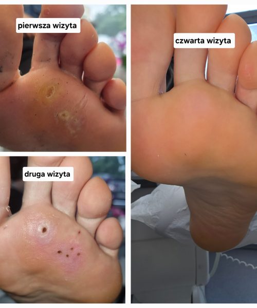 20250312_014727